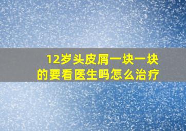 12岁头皮屑一块一块的要看医生吗怎么治疗