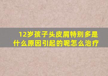 12岁孩子头皮屑特别多是什么原因引起的呢怎么治疗