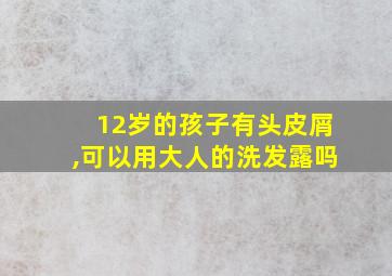 12岁的孩子有头皮屑,可以用大人的洗发露吗