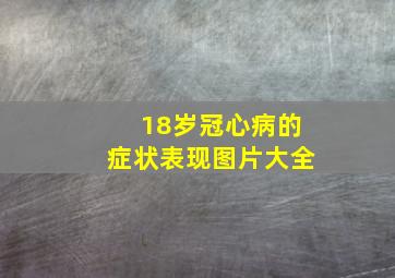 18岁冠心病的症状表现图片大全