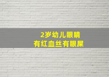 2岁幼儿眼睛有红血丝有眼屎