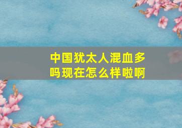 中国犹太人混血多吗现在怎么样啦啊