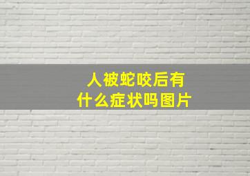 人被蛇咬后有什么症状吗图片