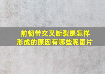 前韧带交叉断裂是怎样形成的原因有哪些呢图片