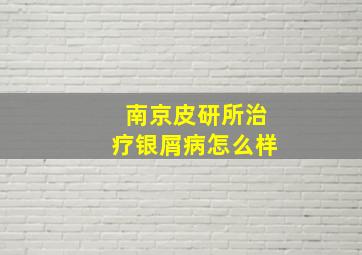 南京皮研所治疗银屑病怎么样