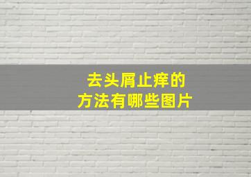 去头屑止痒的方法有哪些图片