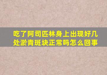 吃了阿司匹林身上出现好几处淤青斑块正常吗怎么回事