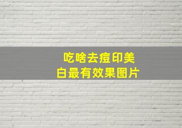 吃啥去痘印美白最有效果图片