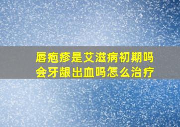 唇疱疹是艾滋病初期吗会牙龈出血吗怎么治疗