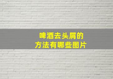 啤酒去头屑的方法有哪些图片