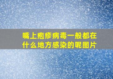 嘴上疱疹病毒一般都在什么地方感染的呢图片