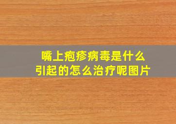 嘴上疱疹病毒是什么引起的怎么治疗呢图片