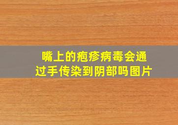 嘴上的疱疹病毒会通过手传染到阴部吗图片