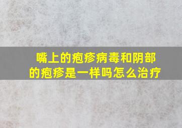 嘴上的疱疹病毒和阴部的疱疹是一样吗怎么治疗