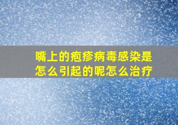 嘴上的疱疹病毒感染是怎么引起的呢怎么治疗