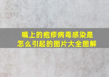 嘴上的疱疹病毒感染是怎么引起的图片大全图解