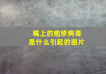 嘴上的疱疹病毒是什么引起的图片