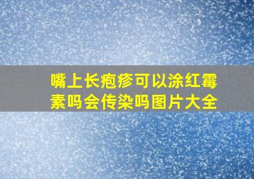 嘴上长疱疹可以涂红霉素吗会传染吗图片大全