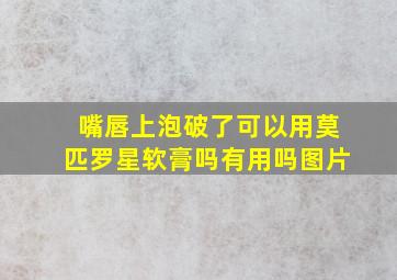 嘴唇上泡破了可以用莫匹罗星软膏吗有用吗图片