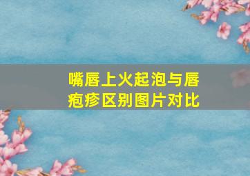 嘴唇上火起泡与唇疱疹区别图片对比