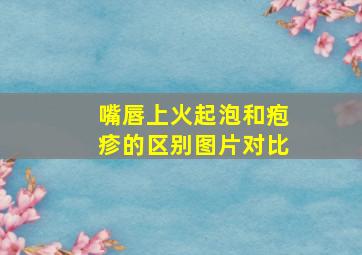 嘴唇上火起泡和疱疹的区别图片对比