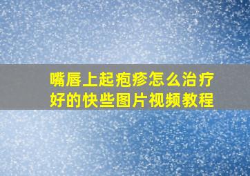 嘴唇上起疱疹怎么治疗好的快些图片视频教程