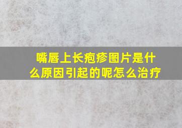 嘴唇上长疱疹图片是什么原因引起的呢怎么治疗