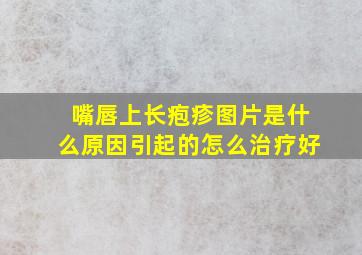 嘴唇上长疱疹图片是什么原因引起的怎么治疗好