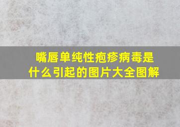 嘴唇单纯性疱疹病毒是什么引起的图片大全图解