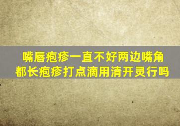 嘴唇疱疹一直不好两边嘴角都长疱疹打点滴用清开灵行吗