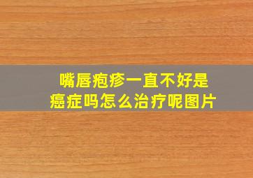 嘴唇疱疹一直不好是癌症吗怎么治疗呢图片