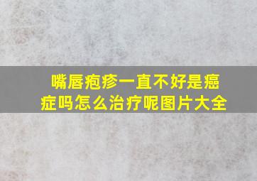 嘴唇疱疹一直不好是癌症吗怎么治疗呢图片大全