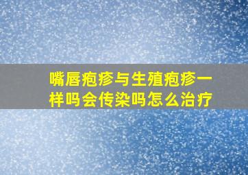 嘴唇疱疹与生殖疱疹一样吗会传染吗怎么治疗