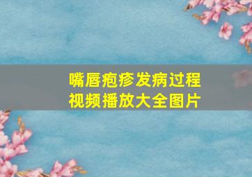 嘴唇疱疹发病过程视频播放大全图片