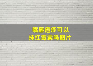 嘴唇疱疹可以抹红霉素吗图片