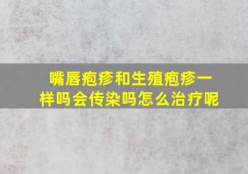 嘴唇疱疹和生殖疱疹一样吗会传染吗怎么治疗呢