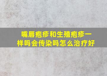 嘴唇疱疹和生殖疱疹一样吗会传染吗怎么治疗好