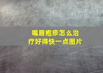 嘴唇疱疹怎么治疗好得快一点图片