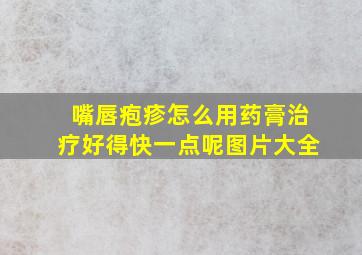 嘴唇疱疹怎么用药膏治疗好得快一点呢图片大全