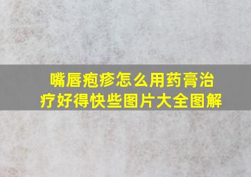 嘴唇疱疹怎么用药膏治疗好得快些图片大全图解