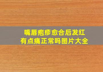 嘴唇疱疹愈合后发红有点痛正常吗图片大全