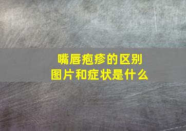 嘴唇疱疹的区别图片和症状是什么