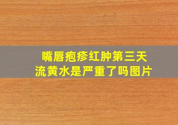 嘴唇疱疹红肿第三天流黄水是严重了吗图片