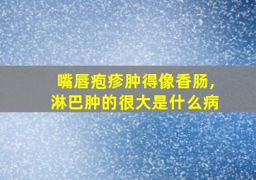 嘴唇疱疹肿得像香肠,淋巴肿的很大是什么病