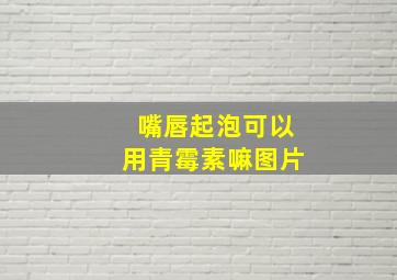 嘴唇起泡可以用青霉素嘛图片