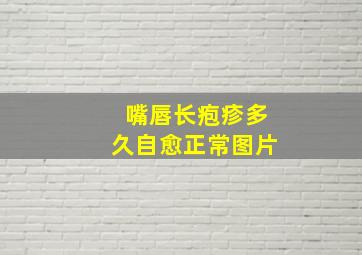 嘴唇长疱疹多久自愈正常图片