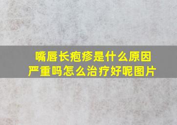 嘴唇长疱疹是什么原因严重吗怎么治疗好呢图片