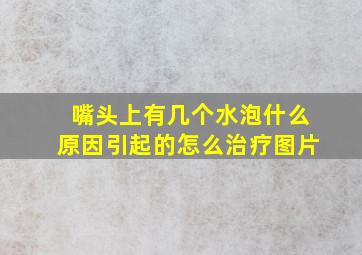 嘴头上有几个水泡什么原因引起的怎么治疗图片