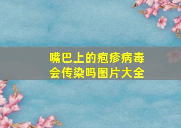 嘴巴上的疱疹病毒会传染吗图片大全