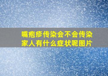 嘴疱疹传染会不会传染家人有什么症状呢图片